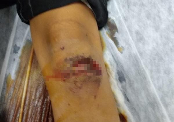 Evine gitmek isterken dehşeti yaşadı