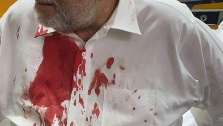 St. Vincent ve Grenadinler Başbakanının kafasına protesto sırasında taş isabet etti