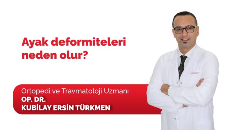 Ayak deformite tedavisinin önemi