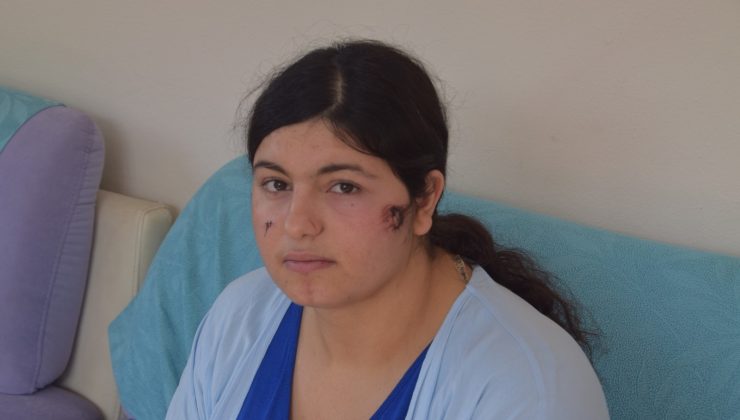 İzmir’de kocası tarafından darp edilen kadın dehşet anlarını anlattı