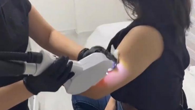 Lazer epilasyon ile istenmeyen tüylere kalıcı çözüm