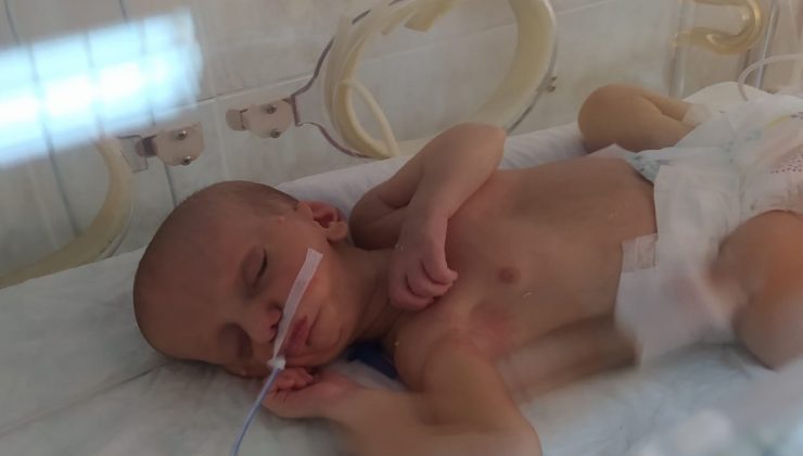 MHP ve AK Parti, doğuştan dudakları yapışık olan Umut bebek için seferber oldu