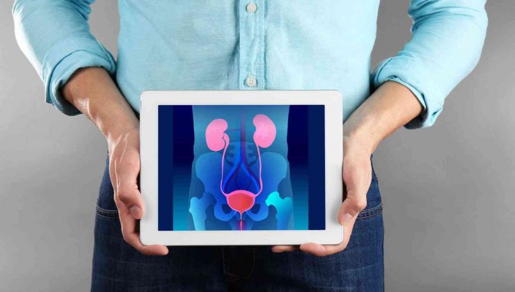 Prostat büyümesine lazer yöntemiyle kesin çözüm